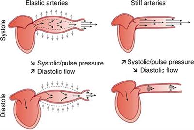 Arterial Stiffness and Hypertension in the Elderly